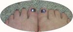Purple toenails with glitter